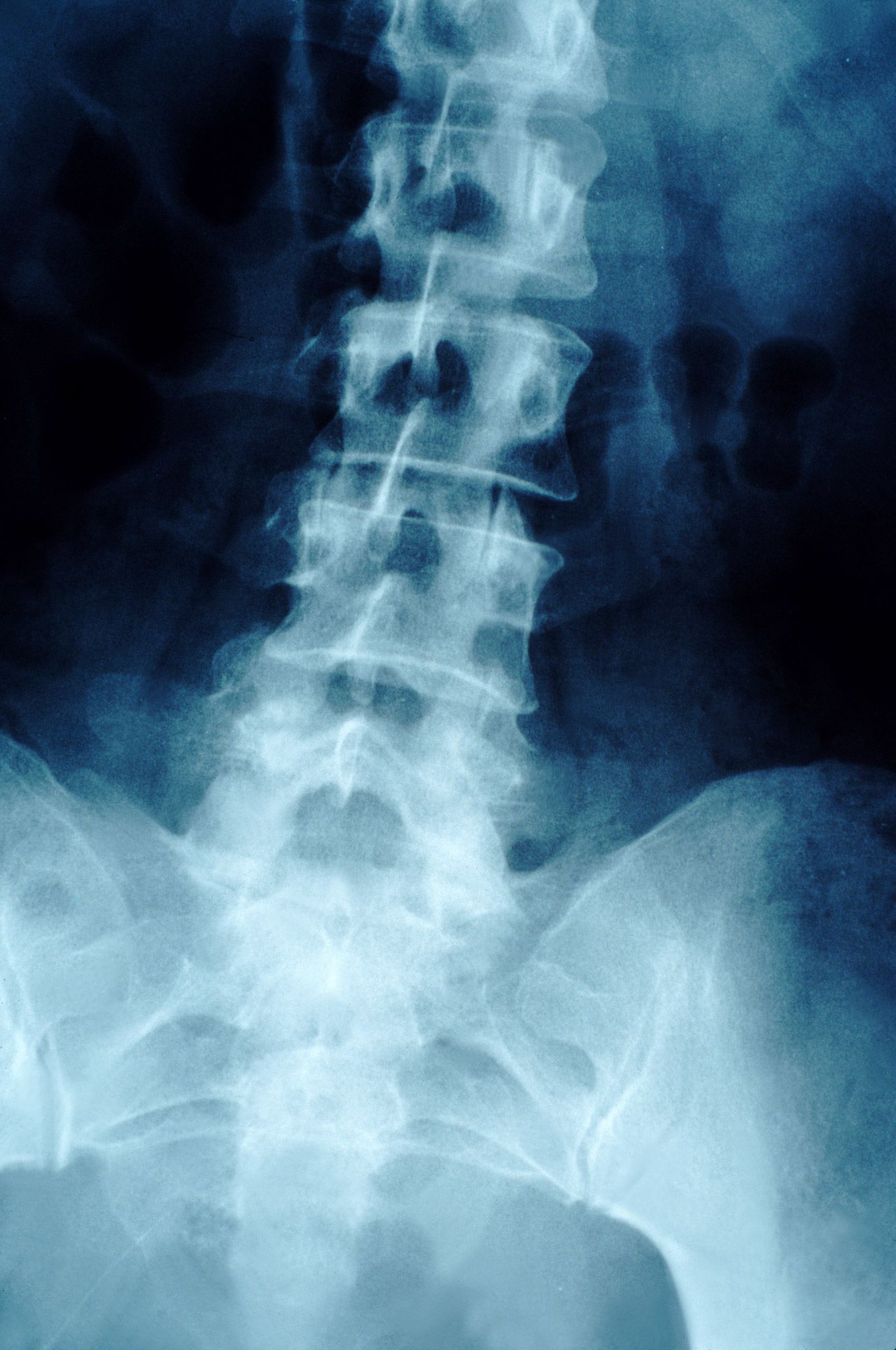 Risques liés aux rayonnements ionisants